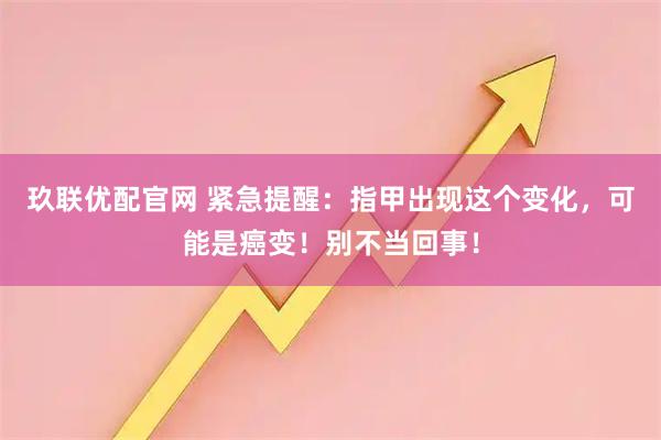 玖联优配官网 紧急提醒：指甲出现这个变化，可能是癌变！别不当回事！